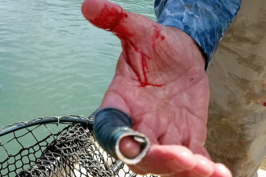 Getting Hooked by a Fishing Hook - Dwayne Hickey