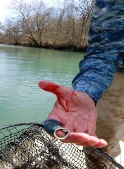 Getting Hooked by a Fishing Hook - Dwayne Hickey